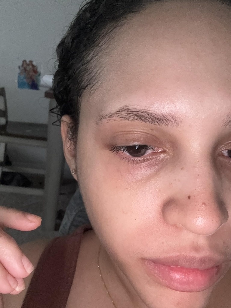 Bare face after applying belif Moisturizing Bomb