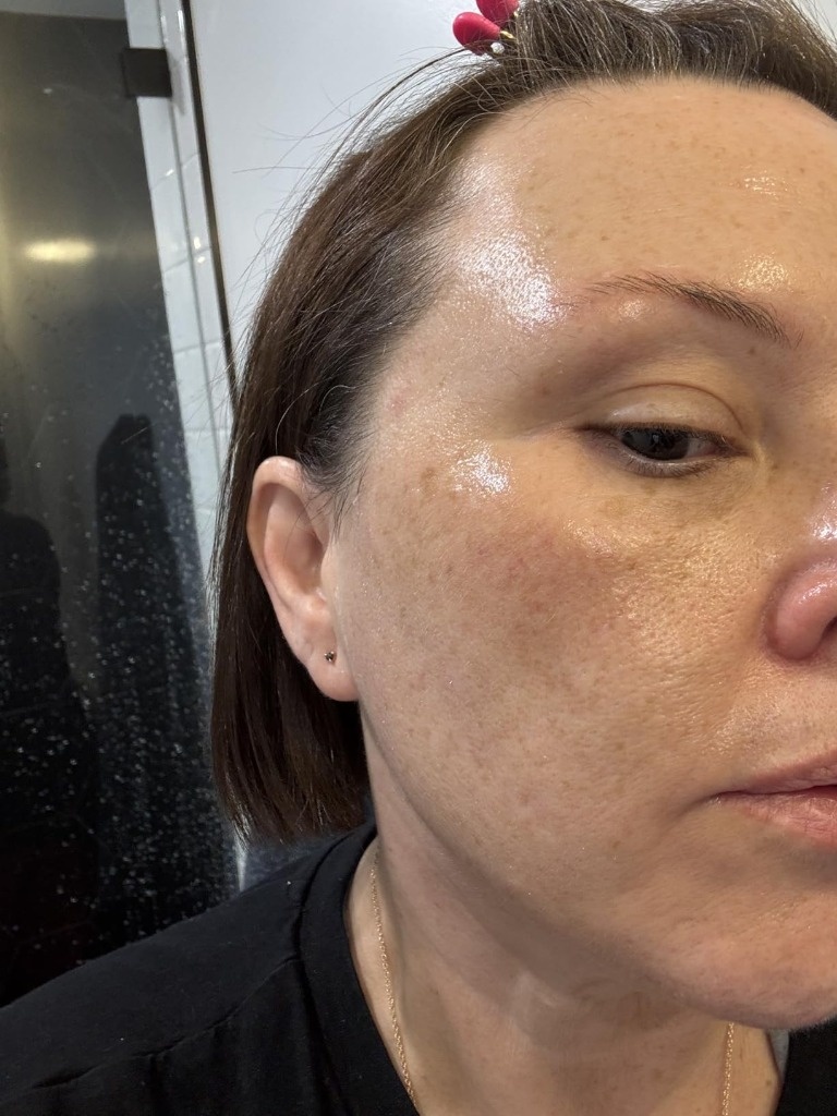 Close-up of face showing glazed glass skin finish post mask peel