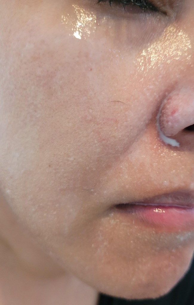 Macro view of milky oil emulsification dissolving sebum on skin
